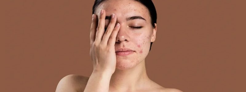 تأثیر استرس محیطی و آلودگی‌های روانی بر روند ترمیم جراحی‌های صورت