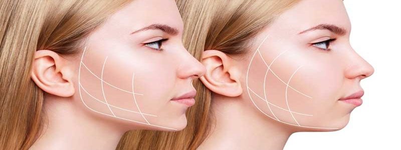 5 سوال متداول در مورد جراحی فک