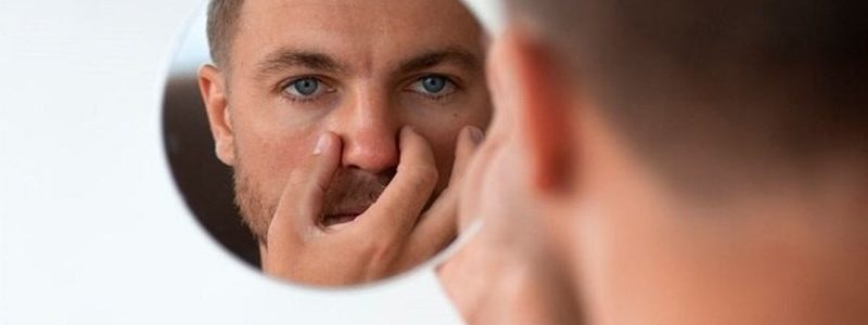 تأثير عملية تجميل الأنف على الحصى