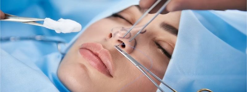 در انتخاب جراح بینی چه نکاتی را باید در نظر گرفت؟
