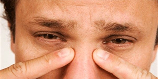 Nasal polyps and symptoms