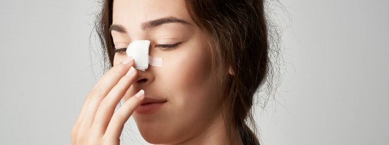 Placer le nez après une rhinoplastie