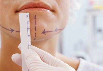 La chirurgie de la mâchoire et du visage(Soins préopératoires)