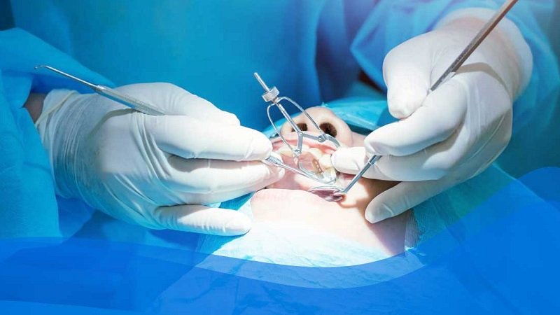 What does a maxillofacial surgeon do? | Isfahan nose surgeon - Jaw surgeon of Isfahan