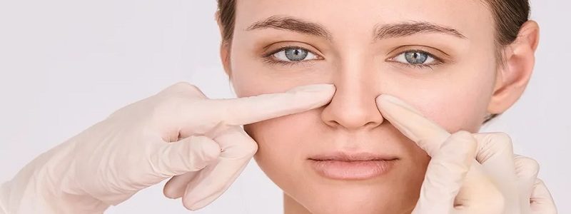 Dangerous mistakes after nose surgery (1)