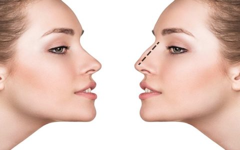 جراحی بینی طبیعی vs. جراحی بینی فانتزی