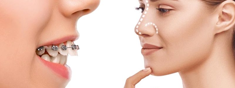 جراحة الأنف والفك: المميزات والعيوب