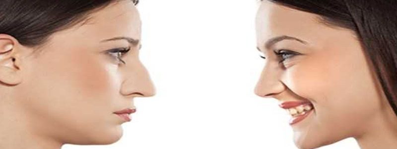 تأثیر نوع خاک و کیفیت هوا در مناطق مختلف بر نتایج جراحی بینی و فک