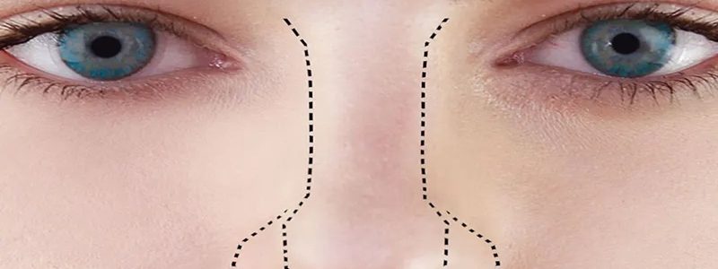 چالش‌های جراحی ترمیمی بینی