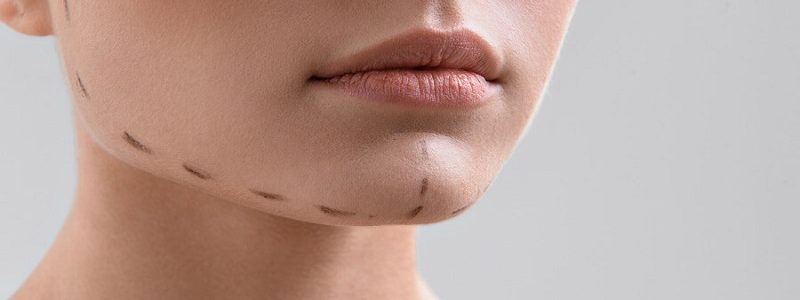 Dos and don'ts of jaw and chin surgery