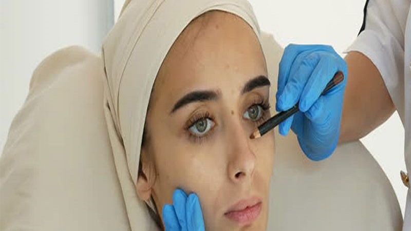 Nose tip surgery | Isfahan nose surgeon