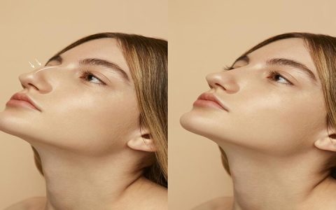 تأثیر جراحی بر سایر اجزای صورت