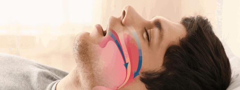 رأب الأنف لمشاكل الجهاز التنفسي