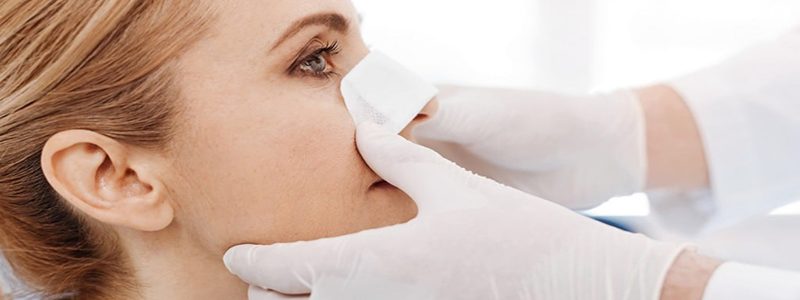 Congé requis après la rhinoplastie