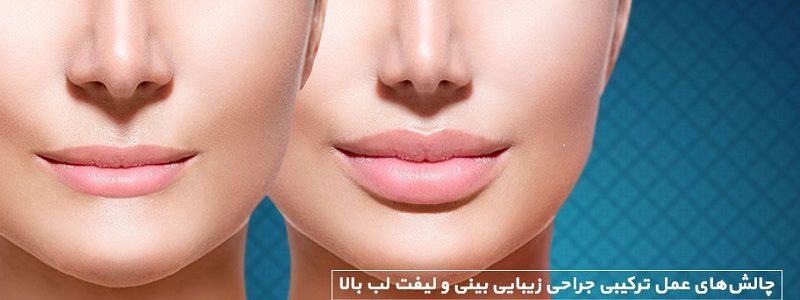 چالش‌های عمل ترکیبی جراحی زیبایی بینی و لیفت لب بالا